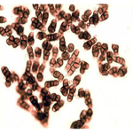 sarocladium oryzae -SPORES